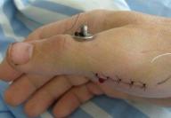 Angeh�ngtes Bild: untitled.jpg